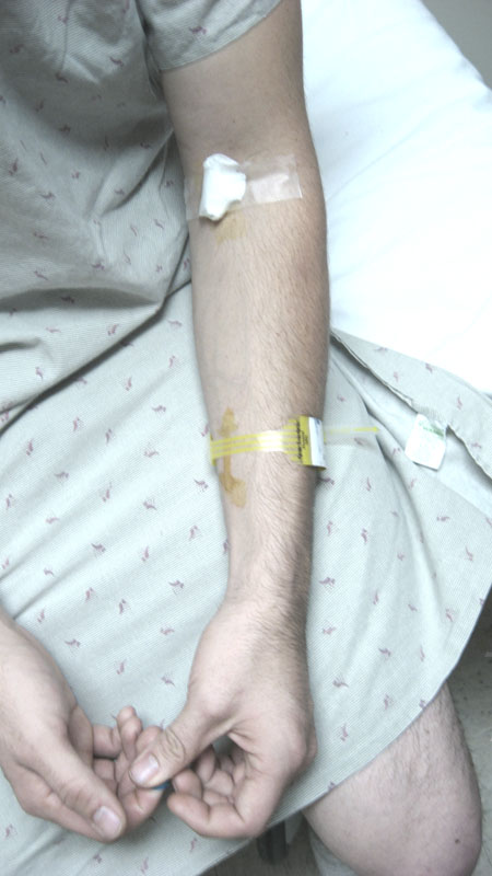 In vein